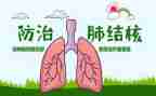 镇级结核防治工作计划5篇