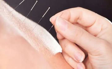 针灸科个人总结5篇